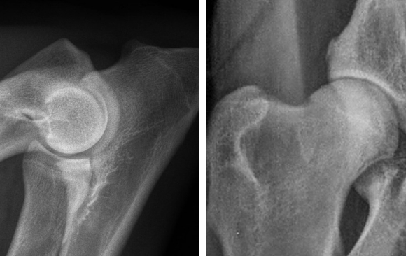 Radiography of Hip and Elbow dysplasia